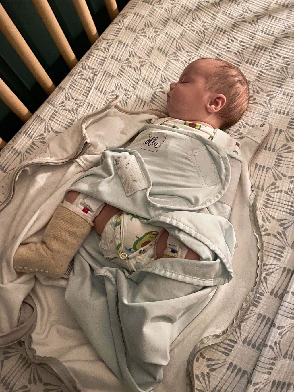Figuring out the best solution for swaddling with hip dysplasia