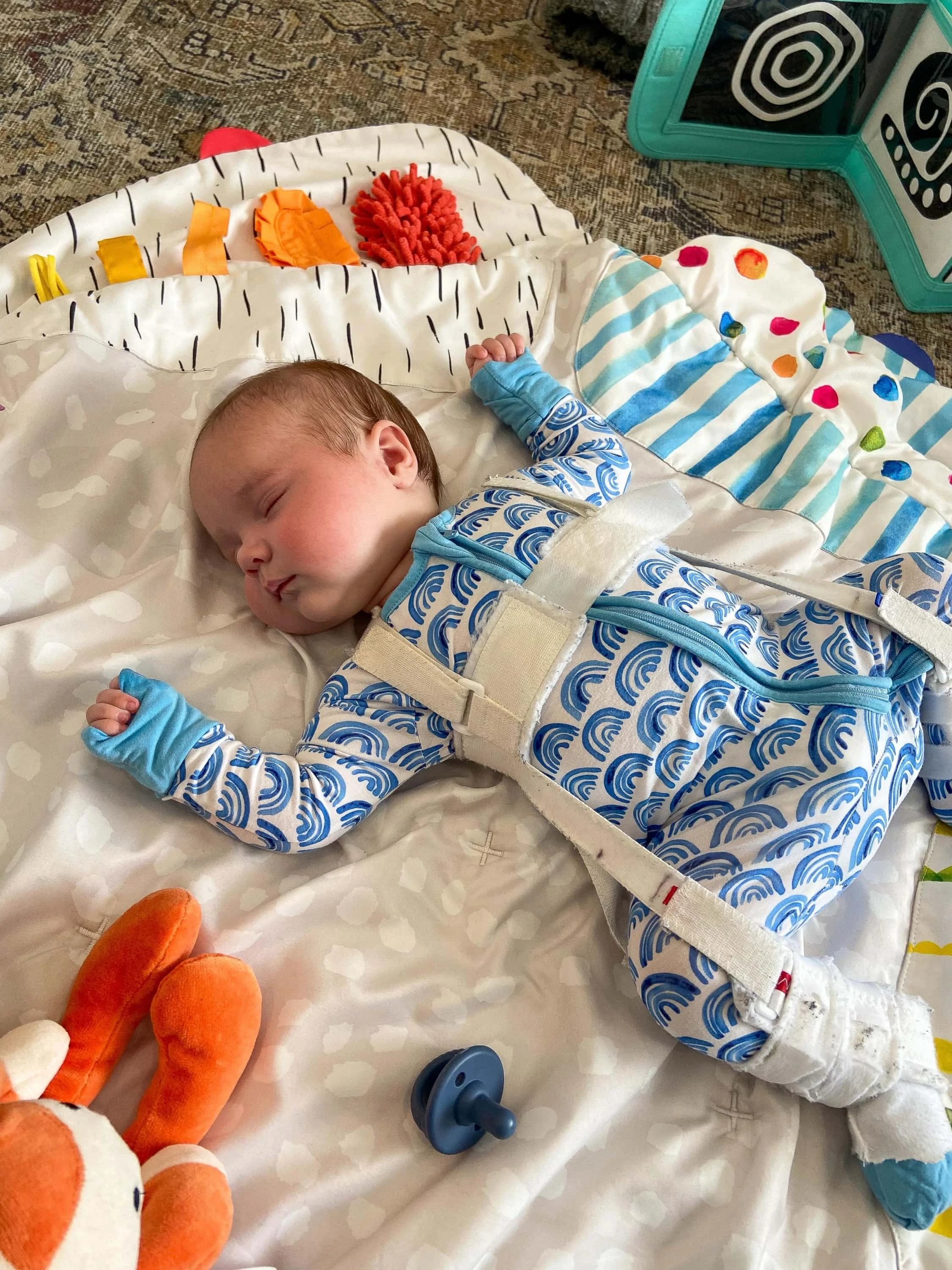 My best tips for infant hip dysplasia and the Pavlik harness